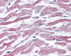 Invitrogen AKT3 Polyclonal Antibody 100 &mu;g; Unconjugated:Antibodies,