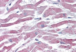 Invitrogen AKT3 Polyclonal Antibody 100 &mu;g; Unconjugated:Antibodies,