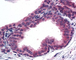 Invitrogen AKT3 Polyclonal Antibody 100 &mu;g; Unconjugated:Antibodies,