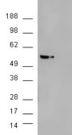 Invitrogen AKT3 Polyclonal Antibody 100 &mu;g; Unconjugated:Antibodies,