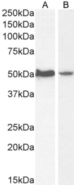 Invitrogen AKT3 Polyclonal Antibody 100 &mu;g; Unconjugated:Antibodies,