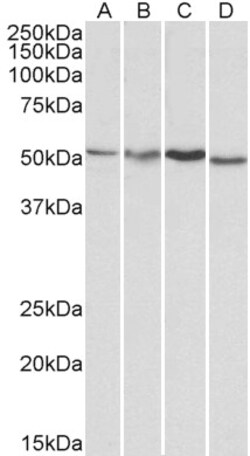 Invitrogen AKT3 Polyclonal Antibody 100 &mu;g; Unconjugated:Antibodies,