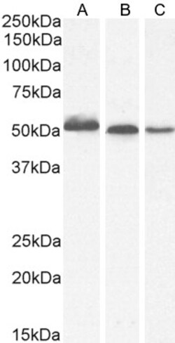 Invitrogen AKT3 Polyclonal Antibody 100 &mu;g; Unconjugated:Antibodies,