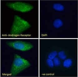 Invitrogen Androgen Receptor Polyclonal Antibody 100 &mu;g; Unconjugated:Antibodies,