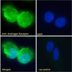Invitrogen Androgen Receptor Polyclonal Antibody 100 &mu;g; Unconjugated:Antibodies,