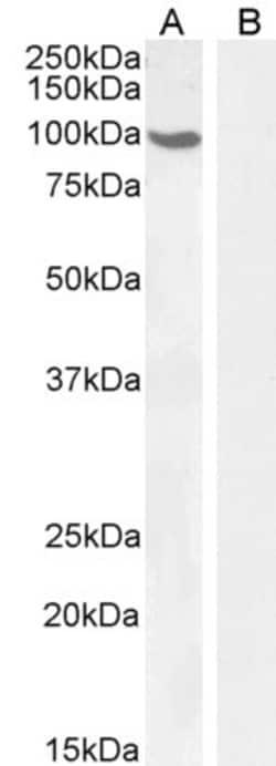 Invitrogen Androgen Receptor Polyclonal Antibody 100 &mu;g; Unconjugated:Antibodies,