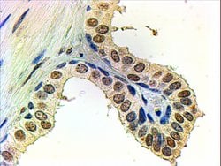 Invitrogen Androgen Receptor Polyclonal Antibody 100 &mu;g; Unconjugated:Antibodies,