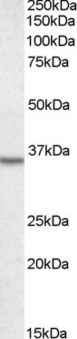 Invitrogen Annexin A2 Polyclonal Antibody 100 &mu;g; Unconjugated:Antibodies,