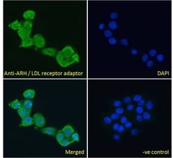 LDLRAP1 Polyclonal Antibody:Antibodies, Polyclonal