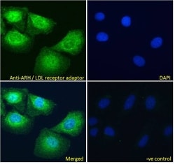 LDLRAP1 Polyclonal Antibody:Antibodies, Polyclonal