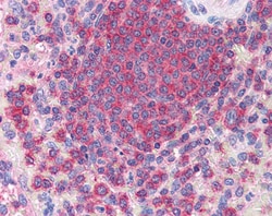 Invitrogen ARPC2 Polyclonal Antibody 100 &mu;g; Unconjugated:Antibodies,