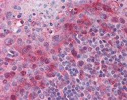 PYCARD Polyclonal Antibody:Antibodies, Polyclonal