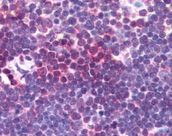 Invitrogen Aurora A Polyclonal Antibody 100 &mu;g; Unconjugated:Antibodies,