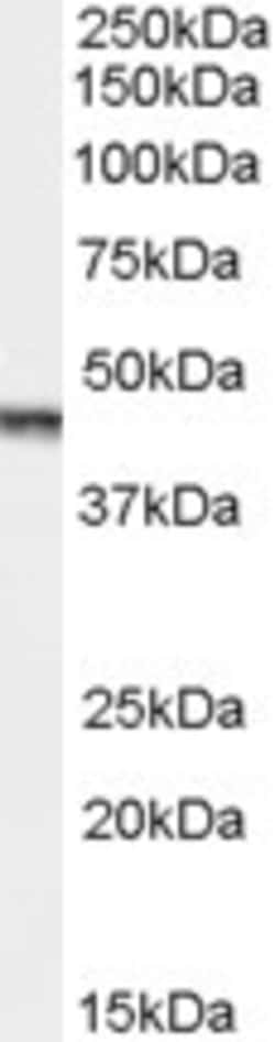 Invitrogen Aurora A Polyclonal Antibody 100 &mu;g; Unconjugated:Antibodies,