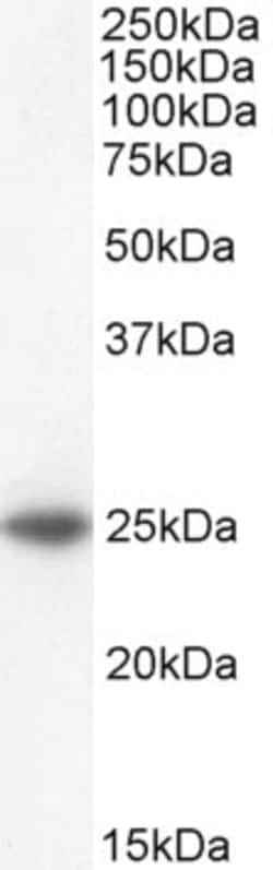 Invitrogen BAK Polyclonal Antibody 100 &mu;g | Buy Online | Invitrogen&trade; | Fisher Scientific