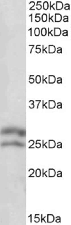 Invitrogen Bcl-2 Polyclonal Antibody 100 &mu;g | Buy Online | Invitrogen&trade; | Fisher Scientific