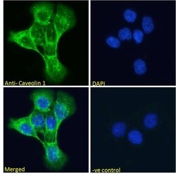 Caveolin 1 Polyclonal Antibody:Antibodies, Polyclonal
