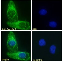 Caveolin 1 Polyclonal Antibody:Antibodies, Polyclonal