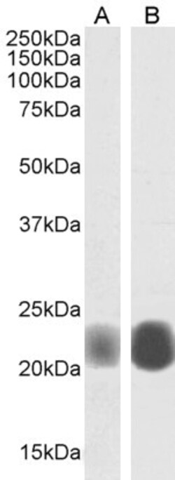 Caveolin 1 Polyclonal Antibody:Antibodies, Polyclonal