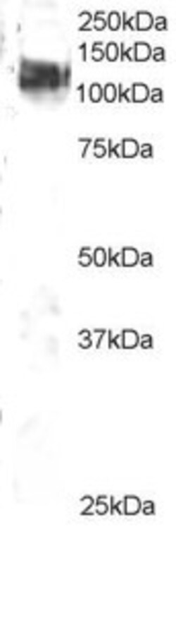Invitrogen c-Cbl Polyclonal Antibody 100 &mu;g; Unconjugated:Antibodies,
