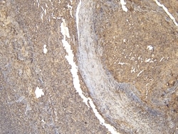 Invitrogen CD20 Polyclonal Antibody 100 &mu;g; Unconjugated:Antibodies,