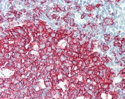 Invitrogen CD20 Polyclonal Antibody 100 &mu;g; Unconjugated:Antibodies,