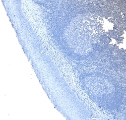 Invitrogen CD20 Polyclonal Antibody 100 &mu;g; Unconjugated:Antibodies,