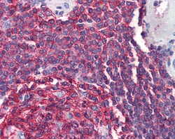 Invitrogen CD20 Polyclonal Antibody 100 &mu;g; Unconjugated:Antibodies,