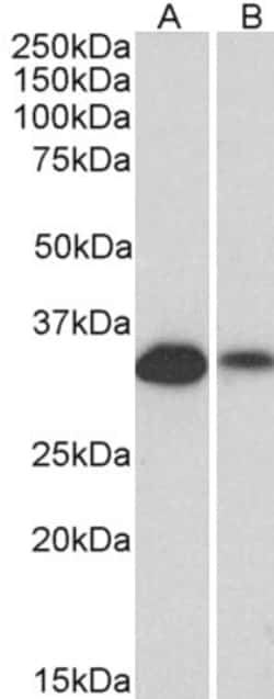 Invitrogen CD20 Polyclonal Antibody 100 &mu;g; Unconjugated:Antibodies,