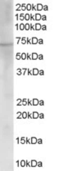 Invitrogen ChAT Polyclonal Antibody 100 &mu;g | Buy Online | Invitrogen&trade; | Fisher Scientific