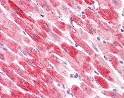 Cofilin 2 Polyclonal Antibody:Antibodies, Polyclonal
