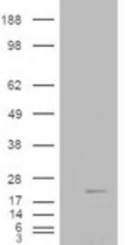 Cofilin 2 Polyclonal Antibody:Antibodies, Polyclonal