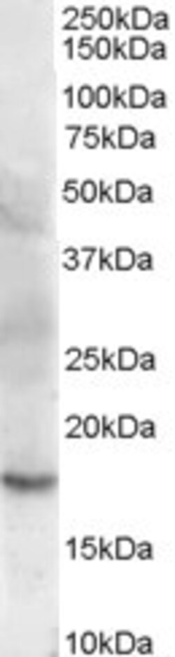 Cofilin 2 Polyclonal Antibody:Antibodies, Polyclonal