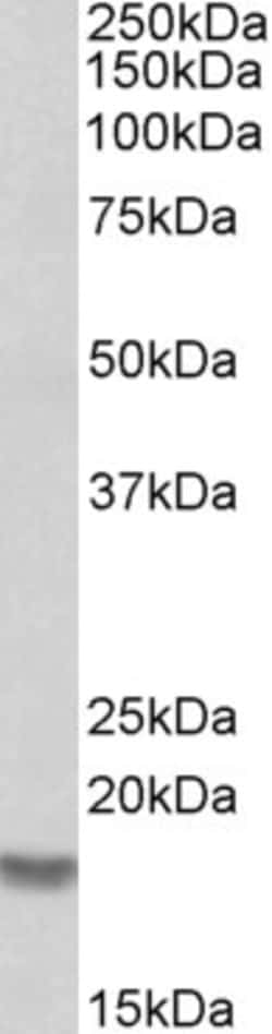Cofilin 2 Polyclonal Antibody:Antibodies, Polyclonal