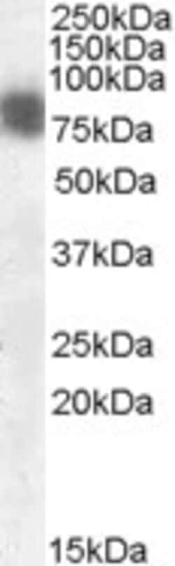 Invitrogen Cortactin Polyclonal Antibody 100 &mu;g; Unconjugated:Antibodies,