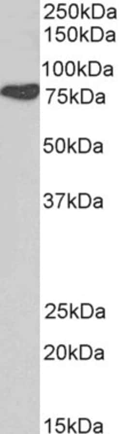 Invitrogen Cortactin Polyclonal Antibody 100 &mu;g; Unconjugated:Antibodies,