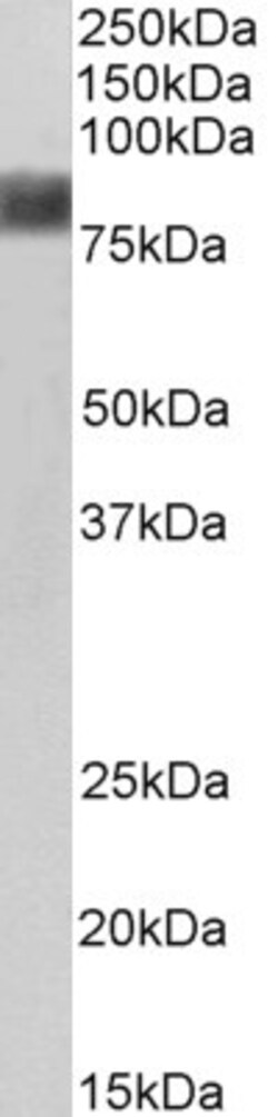Invitrogen Cortactin Polyclonal Antibody 100 &mu;g; Unconjugated:Antibodies,
