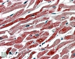 Invitrogen COX1 Polyclonal Antibody 100 &mu;g; Unconjugated:Antibodies,