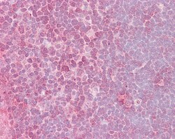 Invitrogen CrkL Polyclonal Antibody 100 &mu;g; Unconjugated:Antibodies,