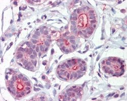 Invitrogen DAPK2 Polyclonal Antibody 100 &mu;g; Unconjugated:Antibodies,