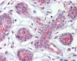 Invitrogen DAPK2 Polyclonal Antibody 100 &mu;g; Unconjugated:Antibodies,