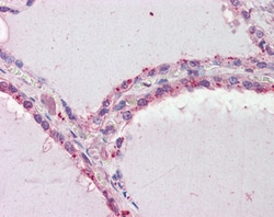 Invitrogen DAPK2 Polyclonal Antibody 100 &mu;g; Unconjugated:Antibodies,