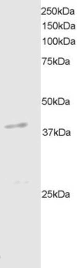 Invitrogen DAPK2 Polyclonal Antibody 100 &mu;g; Unconjugated:Antibodies,