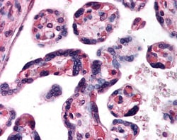 DKK1 Polyclonal Antibody:Antibodies, Polyclonal