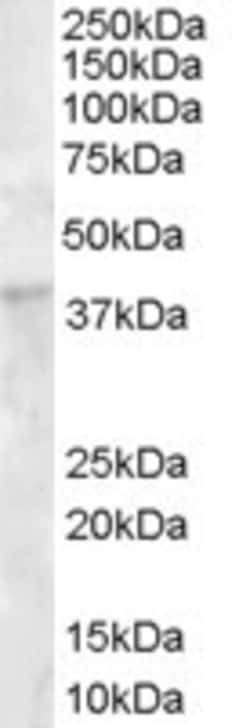 DKK1 Polyclonal Antibody:Antibodies, Polyclonal