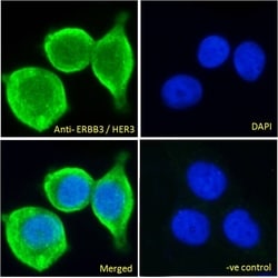 Invitrogen ErbB3 Polyclonal Antibody 100 &mu;g; Unconjugated:Antibodies,