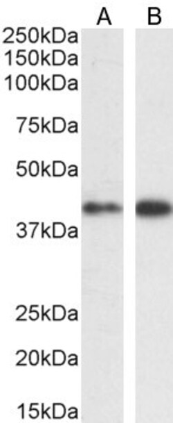 Invitrogen ERK1 Polyclonal Antibody 100 &mu;g; Unconjugated:Antibodies,