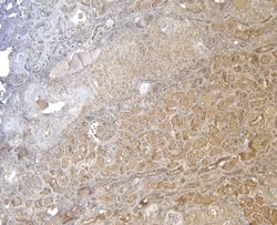 Invitrogen FOXO3A Polyclonal Antibody 100 &mu;g; Unconjugated:Antibodies,