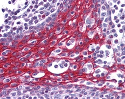 Invitrogen FOXO3A Polyclonal Antibody 100 &mu;g; Unconjugated:Antibodies,