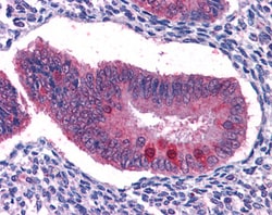 Invitrogen FOXO3A Polyclonal Antibody 100 &mu;g; Unconjugated:Antibodies,